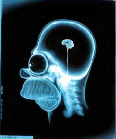 Homer's Brain Scan